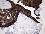 Acidic Cytokeratin Antibody in Immunohistochemistry (Paraffin) (IHC (P))