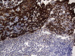 Acidic Cytokeratin Antibody in Immunohistochemistry (Paraffin) (IHC (P))