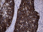 Acidic Cytokeratin Antibody in Immunohistochemistry (Paraffin) (IHC (P))