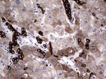 Acidic Cytokeratin Antibody in Immunohistochemistry (Paraffin) (IHC (P))