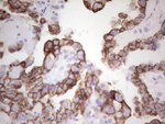 Acidic Cytokeratin Antibody in Immunohistochemistry (Paraffin) (IHC (P))