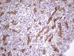 Acidic Cytokeratin Antibody in Immunohistochemistry (Paraffin) (IHC (P))