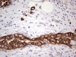 Acidic Cytokeratin Antibody in Immunohistochemistry (Paraffin) (IHC (P))