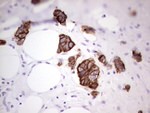 Acidic Cytokeratin Antibody in Immunohistochemistry (Paraffin) (IHC (P))