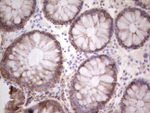 Acidic Cytokeratin Antibody in Immunohistochemistry (Paraffin) (IHC (P))