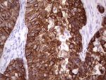 Acidic Cytokeratin Antibody in Immunohistochemistry (Paraffin) (IHC (P))