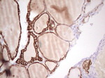 Basic Cytokeratin Antibody in Immunohistochemistry (Paraffin) (IHC (P))