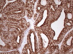 Basic Cytokeratin Antibody in Immunohistochemistry (Paraffin) (IHC (P))