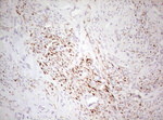 Basic Cytokeratin Antibody in Immunohistochemistry (Paraffin) (IHC (P))