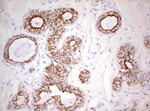 Basic Cytokeratin Antibody in Immunohistochemistry (Paraffin) (IHC (P))