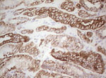 Basic Cytokeratin Antibody in Immunohistochemistry (Paraffin) (IHC (P))