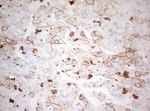 Basic Cytokeratin Antibody in Immunohistochemistry (Paraffin) (IHC (P))