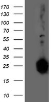 Adiponectin Antibody in Western Blot (WB)