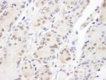 Aladin Antibody in Immunohistochemistry (IHC)