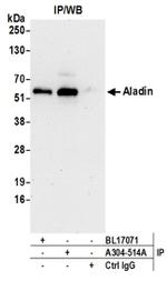 Aladin Antibody in Western Blot (WB)