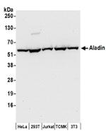 Aladin Antibody in Western Blot (WB)