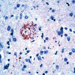 Amyloid Precursor Protein Antibody in Immunohistochemistry (Paraffin) (IHC (P))