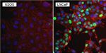 Androgen Receptor Antibody in Immunocytochemistry (ICC/IF)