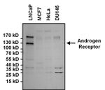 Androgen Receptor Antibody in Western Blot (WB)