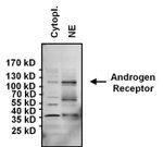 Androgen Receptor Antibody in Western Blot (WB)