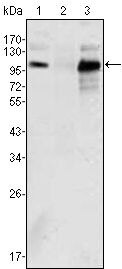 Androgen Receptor Antibody in Western Blot (WB)