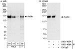 Anillin Antibody in Western Blot (WB)