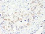 Anillin Antibody in Immunohistochemistry (IHC)