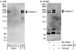 Ankyrin 1 Antibody in Western Blot (WB)