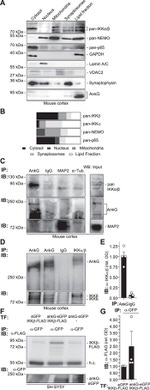 Ankyrin G Antibody in Western Blot (WB)