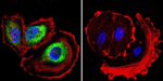 ARF6 Antibody in Immunocytochemistry (ICC/IF)