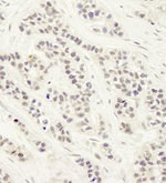 Artemis Antibody in Immunohistochemistry (IHC)