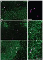 CD45R (B220) Antibody in Immunohistochemistry (IHC)