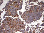 B2M Antibody in Immunohistochemistry (Paraffin) (IHC (P))