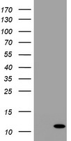 B2M Antibody in Western Blot (WB)