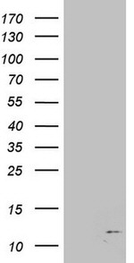 B2M Antibody in Western Blot (WB)