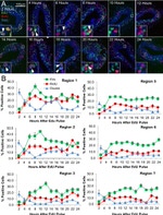 BrdU Antibody in Immunohistochemistry (IHC)