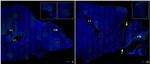 BrdU Antibody in Immunohistochemistry (IHC)