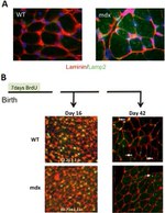 BrdU Antibody in Immunohistochemistry (IHC)