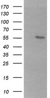 B3GALNT2 Antibody in Western Blot (WB)
