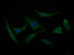 B3GNT2 Antibody in Immunocytochemistry (ICC/IF)