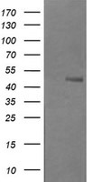 B3GNT2 Antibody in Western Blot (WB)