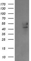 B3GNT2 Antibody in Western Blot (WB)