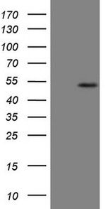 B4GALT4 Antibody in Western Blot (WB)