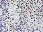 BACH1 Antibody in Immunohistochemistry (Paraffin) (IHC (P))