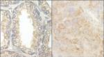 BAD Antibody in Immunohistochemistry (IHC)