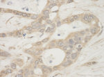 BAD Antibody in Immunohistochemistry (IHC)