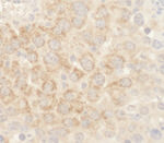 BAD Antibody in Immunohistochemistry (IHC)