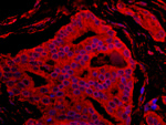 BAD Antibody in Immunohistochemistry (IHC)