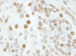 BAF53A Antibody in Immunohistochemistry (IHC)