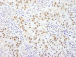 BAF53A Antibody in Immunohistochemistry (IHC)